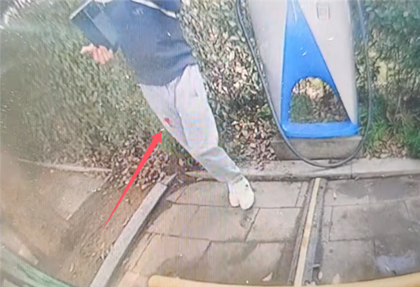 男子充电时遭充电枪反弹致嘴唇开裂：被缝8针