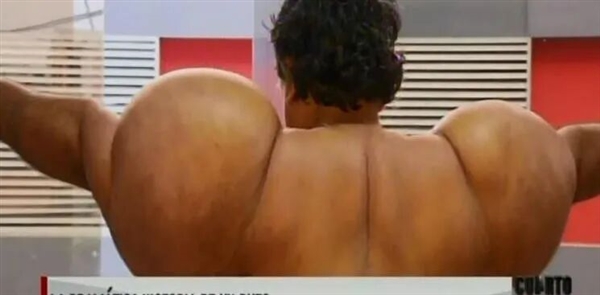 男子潜水氧气管被切断 全身肿胀如大肌霸!11年治疗无果